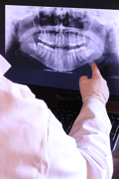 Best Emergency Dentist for Knocked-Out Tooth in Rogers City, MI
